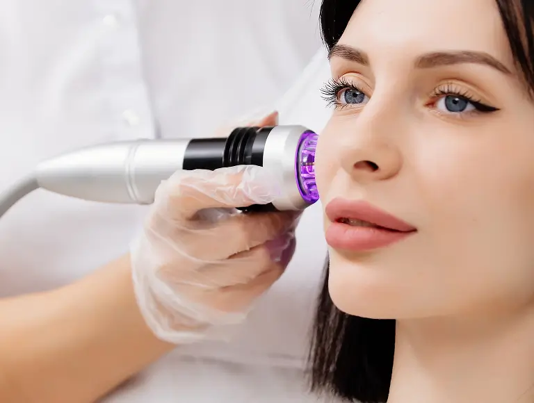 Fractional Radiofrequency