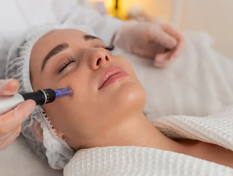 The Perfect Derma Peel