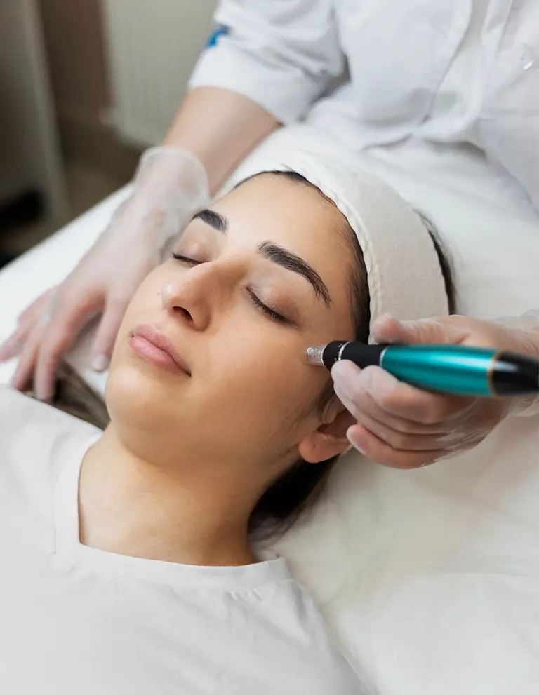Microneedling